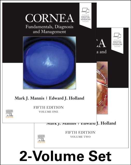 Cornea 2Volume Set