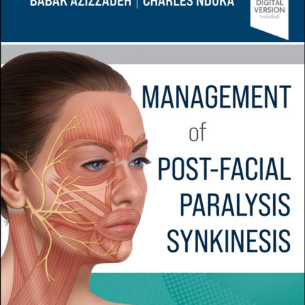 Management of Post-Facial Paralysis Synkinesis