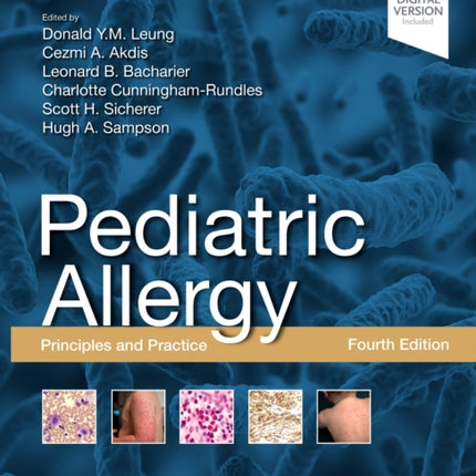 Pediatric Allergy: Principles and Practice: Principles and Practice