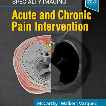 Specialty Imaging: Acute and Chronic Pain Intervention