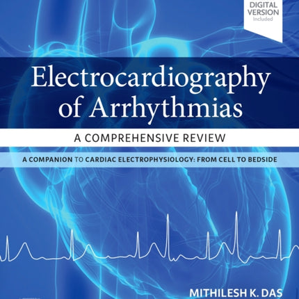 Electrocardiography of Arrhythmias: A Comprehensive Review