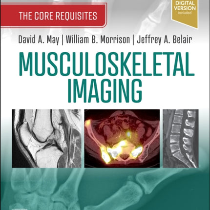 Musculoskeletal Imaging: The Core Requisites