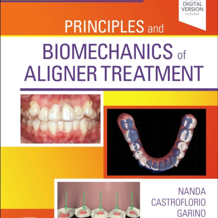 Principles and Biomechanics of Aligner Treatment