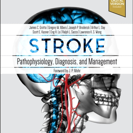 Stroke: Pathophysiology, Diagnosis, and Management