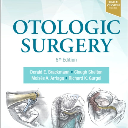 Otologic Surgery