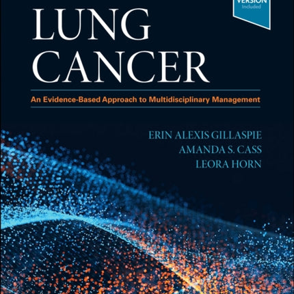 Lung Cancer: An Evidence-Based Approach to Multidisciplinary Management