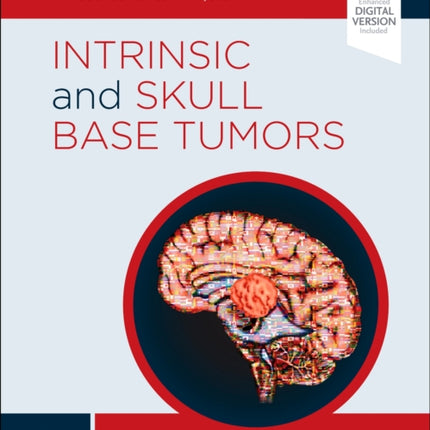 Intrinsic and Skull Base Tumors: Neurosurgery: Case Management Comparison Series