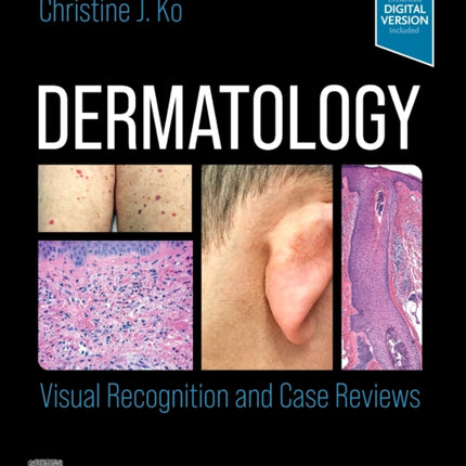 Dermatology: Visual Recognition and Case Reviews