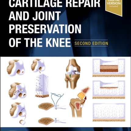 Cartilage Repair and Joint Preservation of the
