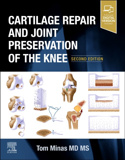 Cartilage Repair and Joint Preservation of the