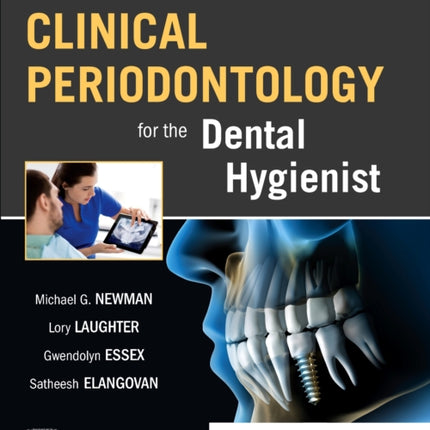 Newman and Carranza's Clinical Periodontology for the Dental Hygienist