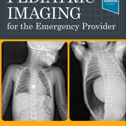 Pediatric Imaging for the Emergency Provider
