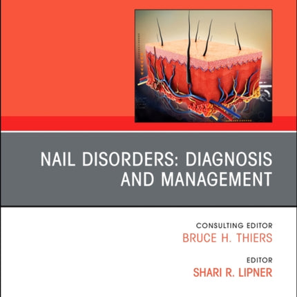 Nail Disorders Diagnosis and Management An Issue