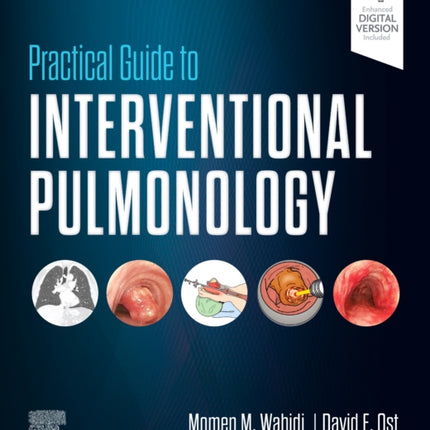 Practical Guide to Interventional Pulmonology