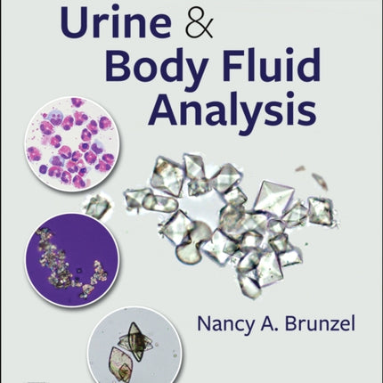 Fundamentals of Urine and Body Fluid Analysis