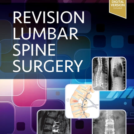 Revision Lumbar Spine Surgery