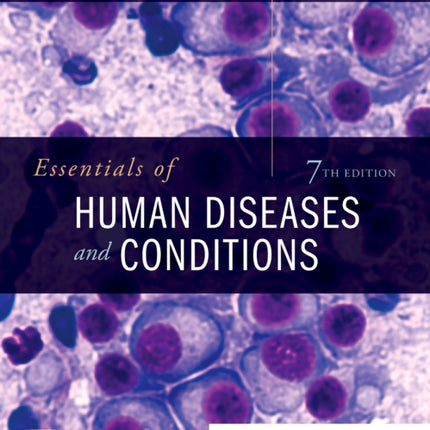 Essentials of Human Diseases and Conditions