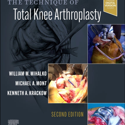 The Technique of Total Knee Arthroplasty