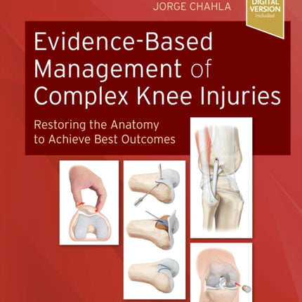 Evidence-Based Management of Complex Knee Injuries: Restoring the Anatomy to Achieve Best Outcomes