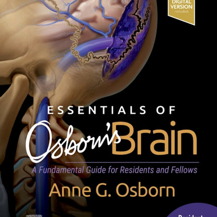 Essentials of Osborn's Brain: A Fundamental Guide for Residents and Fellows