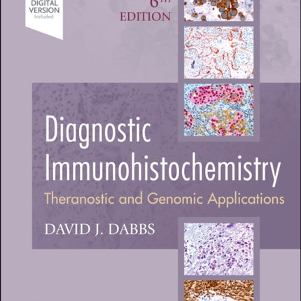 Diagnostic Immunohistochemistry: Theranostic and Genomic Applications