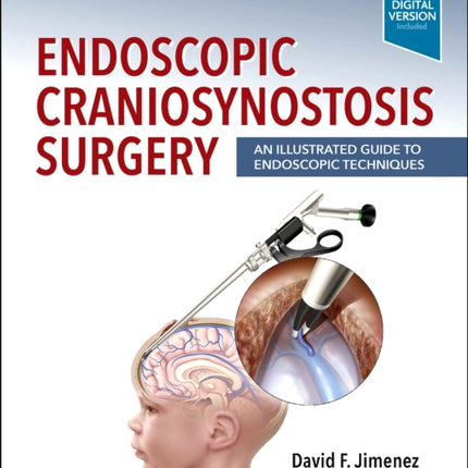 Endoscopic Craniosynostosis Surgery: An Illustrated Guide to Endoscopic Techniques