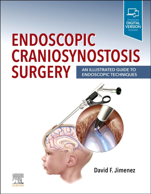 Endoscopic Craniosynostosis Surgery: An Illustrated Guide to Endoscopic Techniques