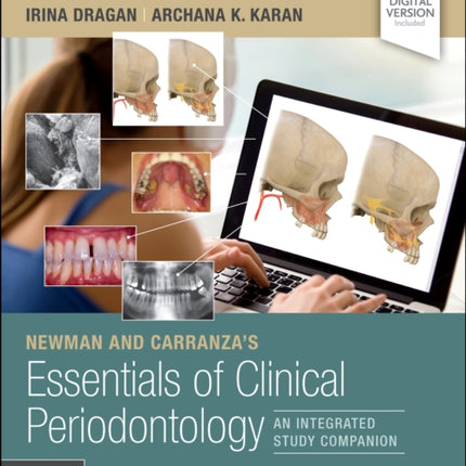 Newman and Carranza's Essentials of Clinical Periodontology: An Integrated Study Companion