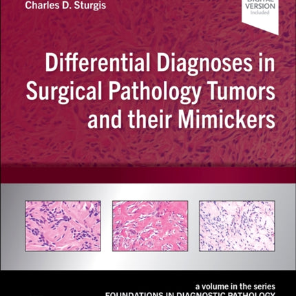 Differential Diagnoses in Surgical Pathology Tumors and their Mimickers: A Volume in the Foundations in Diagnostic Pathology series