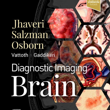 Diagnostic Imaging: Brain