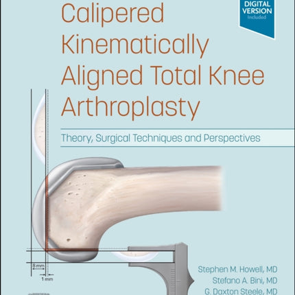 Calipered Kinematically aligned Total Knee Arthroplasty: Theory, Surgical Techniques and Perspectives