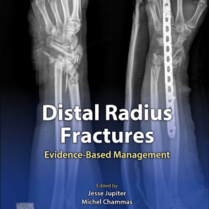 Distal Radius Fractures