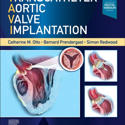 Transcatheter Aortic Valve Implantation