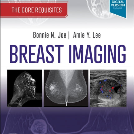 Breast Imaging: The Core Requisites