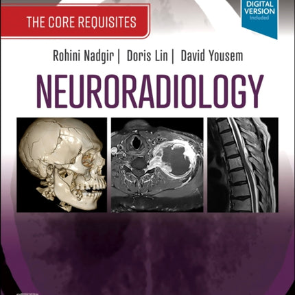 Neuroradiology