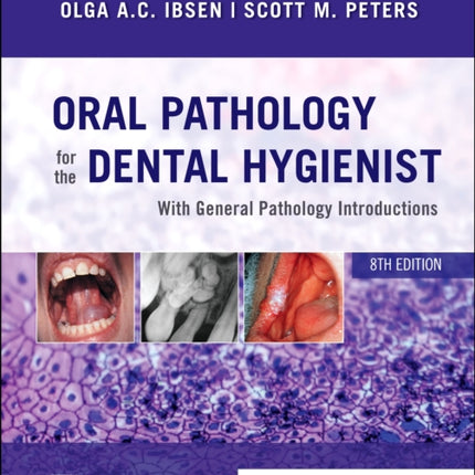 Oral Pathology for the Dental Hygienist