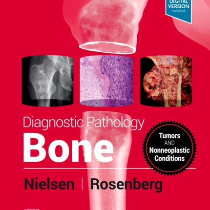 Diagnostic Pathology: Bone