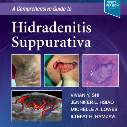 A Comprehensive Guide to Hidradenitis Suppurativa