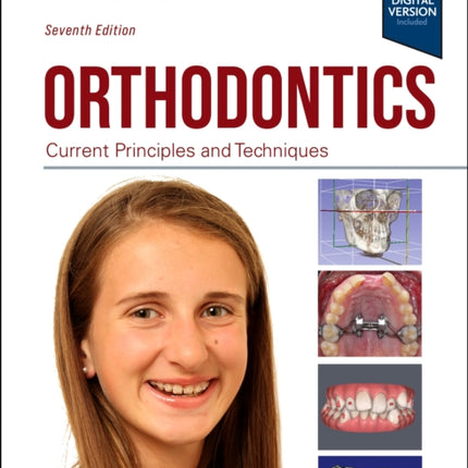 Orthodontics: Current Principles and Techniques