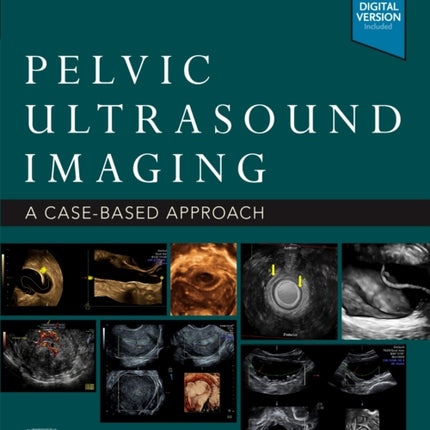 Pelvic Ultrasound Imaging: A Cased-Based Approach