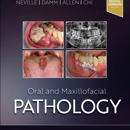 Oral and Maxillofacial Pathology