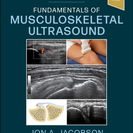 Fundamentals of Musculoskeletal Ultrasound