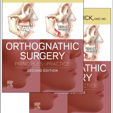 Orthognathic Surgery  2 Volume Set