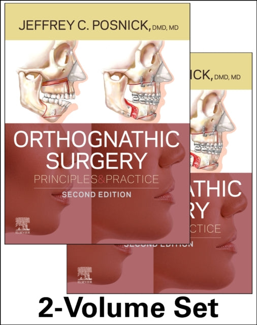 Orthognathic Surgery  2 Volume Set