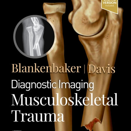 Diagnostic Imaging: Musculoskeletal Trauma