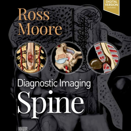 Diagnostic Imaging: Spine