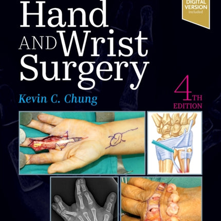 Operative Techniques Hand and Wrist Surgery