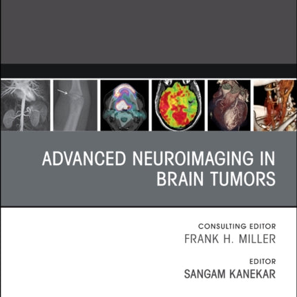 Advanced Neuroimaging in Brain Tumors An Issue of