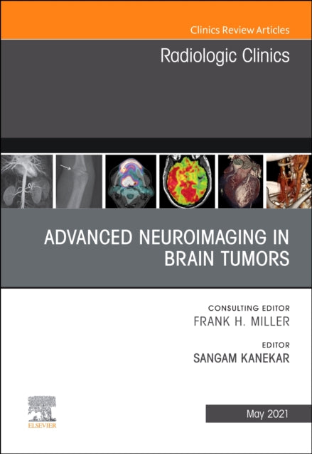 Advanced Neuroimaging in Brain Tumors An Issue of