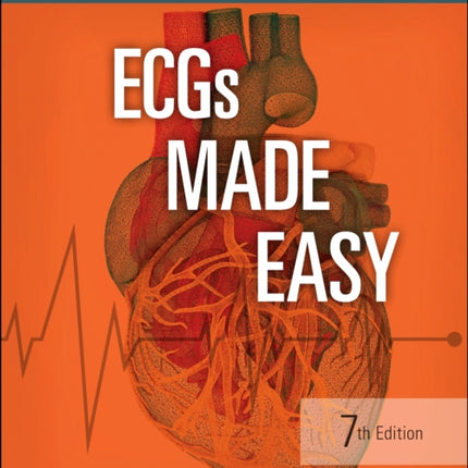 ECGs Made Easy